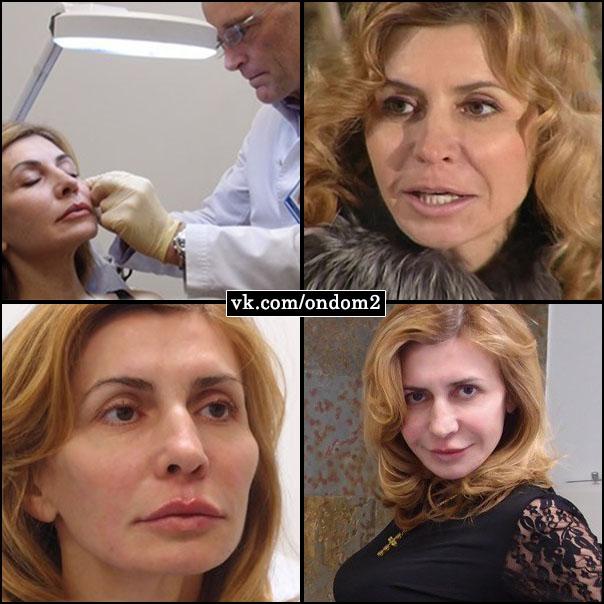 Ирина до и после