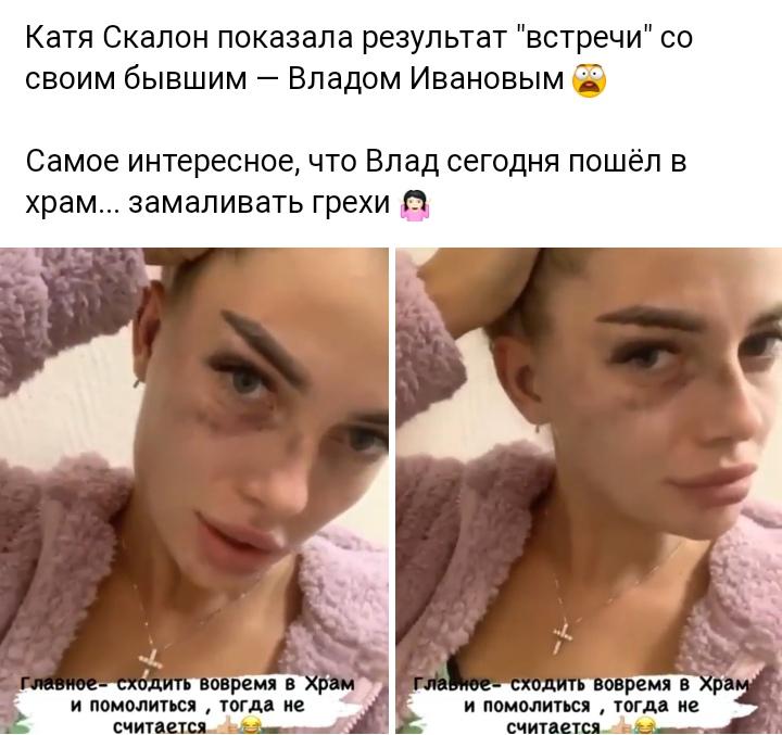 Катя Скалон Порно