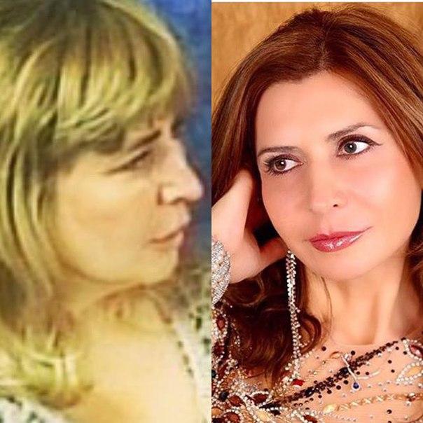 Агибалова до и после операции Стареть надо достойно и не обманывать не себя, ни людей - Дом 2 новости