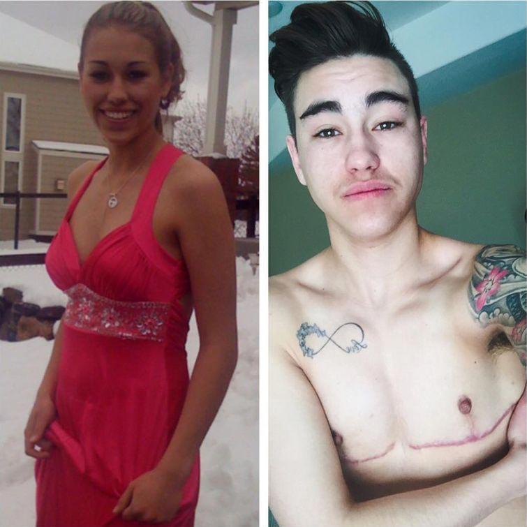 Cost of transsexual surgeries