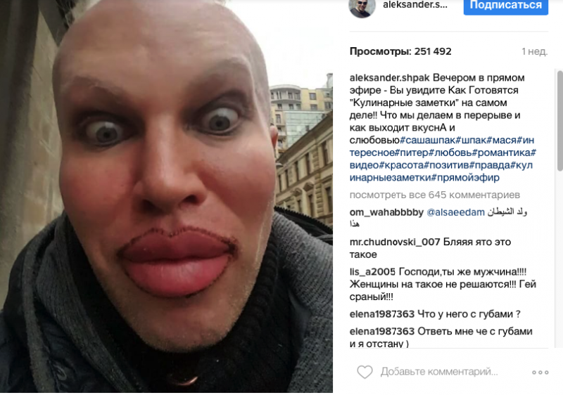 Мальчик с накаченными губами