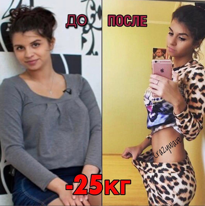 Фото Алианы До Пластики И После