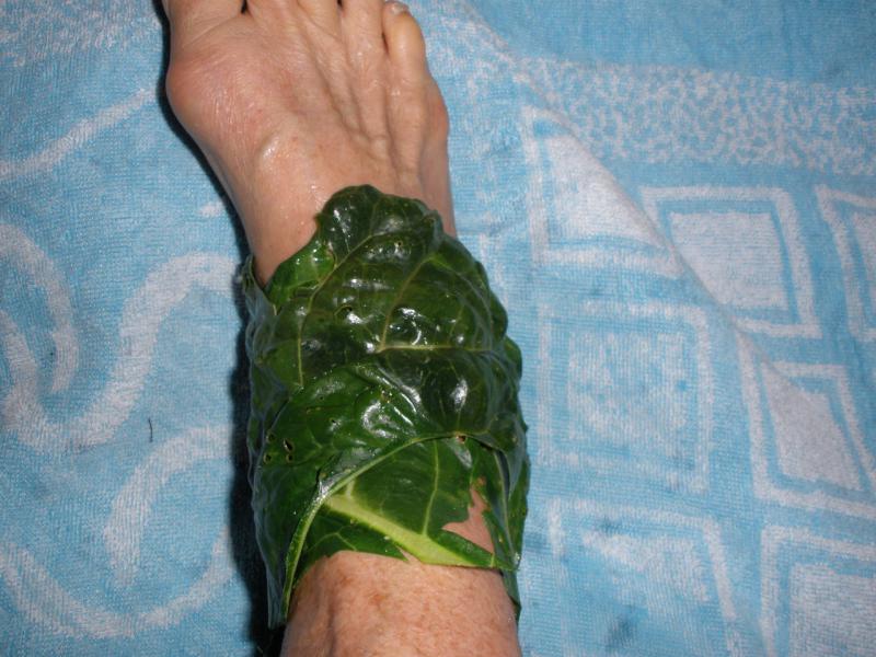 Лечение артрита капустным листом отзывы