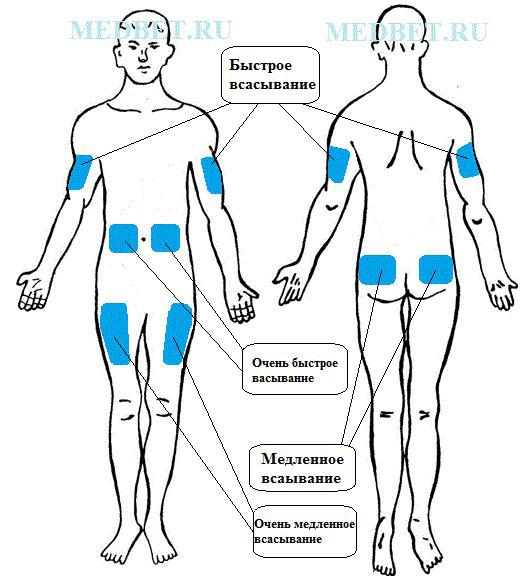 Куда делать укол в бедро схема