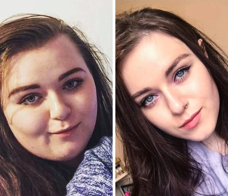 Резко изменилось лицо. Лицо до и после похудения. Меняется лицо после похудения. Толстое лицо до и после. Лицо после похудения до и после.