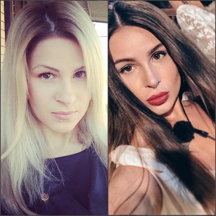 Голд до и после пластики