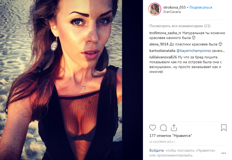 Таня Строкова До Пластики И После Фото