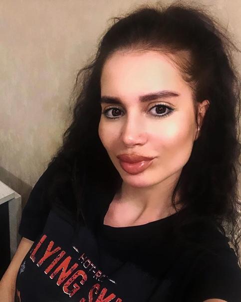 Брутян до и после пластики Оказывается, до пластики Иванна Хаврак была совсем страшной.. - Дом 2 новости