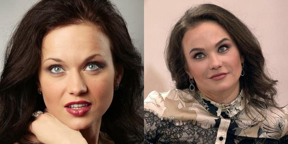 Мария берсенева до и после пластики